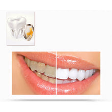 2ml Transparent White Teeth High Strength Whitening Gel Pen Whitener Tooth Pen Dental Equipment LE2